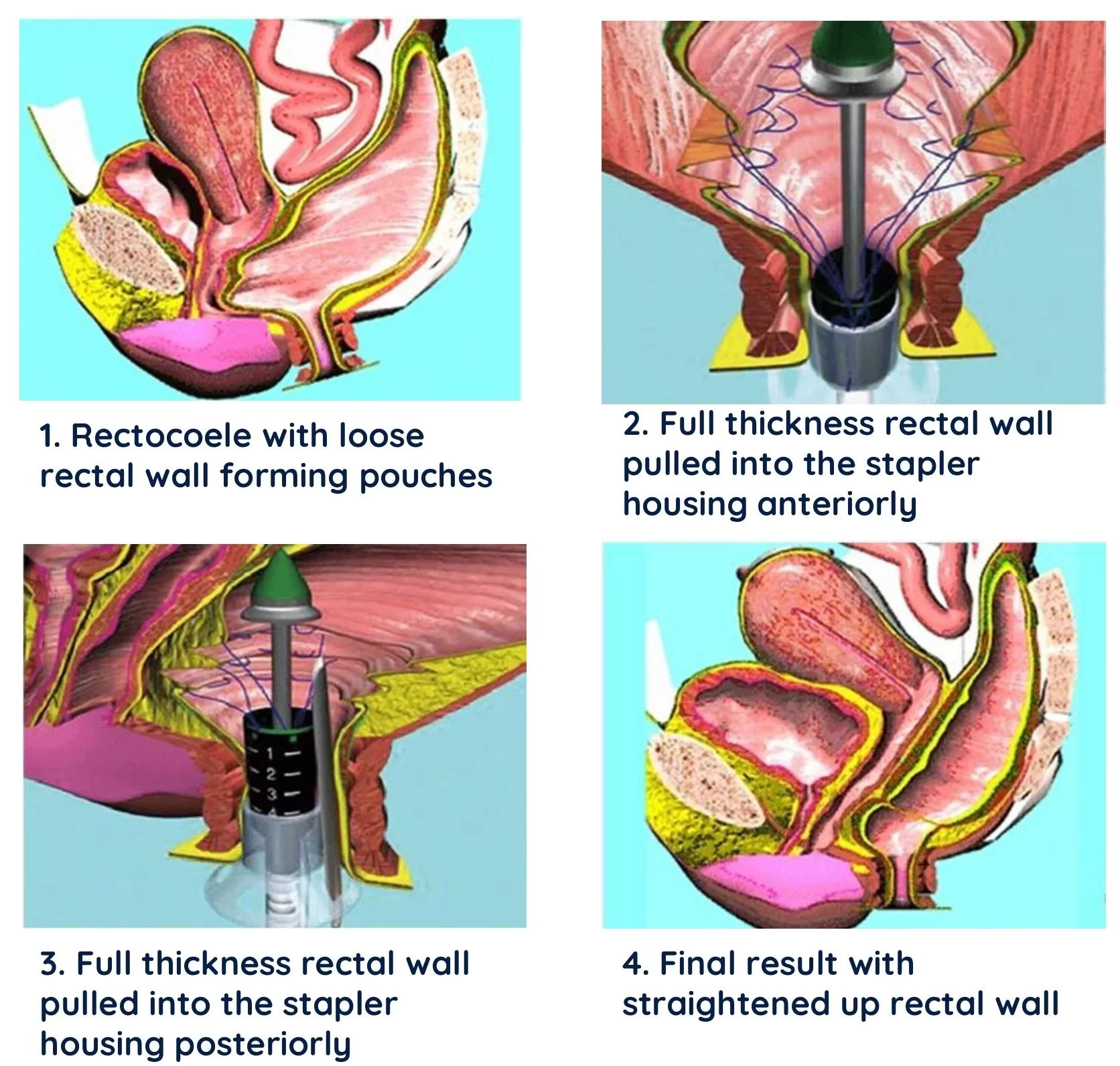 Star surgery pdf picture page 0002 e1696492191180