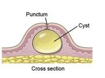 cross section001 e1680260396132