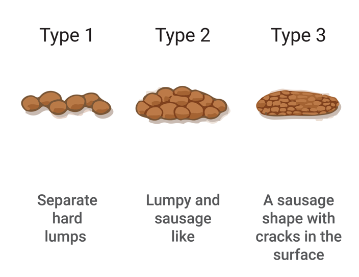 stool1